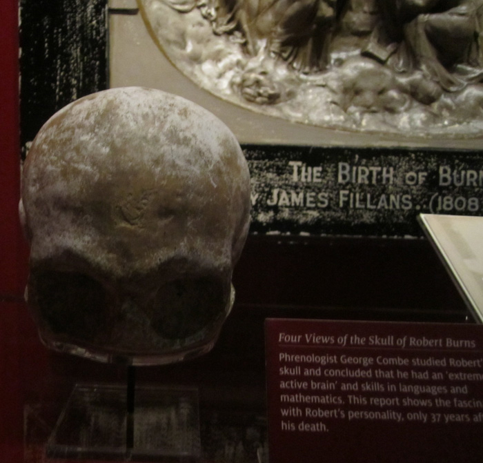 Burns' skull